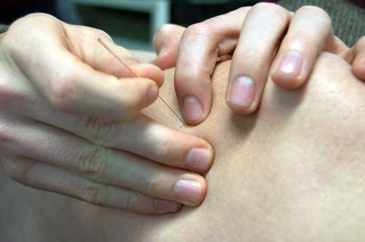 myofasciale-therapie-3.jpg